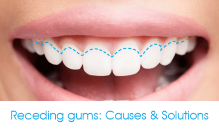 What Causes Receding Gums? (And How To Fix It)