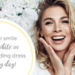Wedding Planning – Getting Your Smile Ready for the Big Day