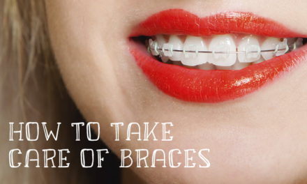 How To Care For Teeth With Braces: Tips for New Braces Wearers